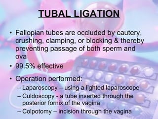 Family planning delfin | PPT