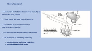 What Is Vasectomy?
• A permanent method of contraception for men who do
not want any more children
• A safe, simple, and short surgical procedure
• Also referred to as male sterilization or
male surgical contraception
• Procedure requires a trained health care provider
• Two techniques for performing vasectomy
• Conventional or incisional vasectomy
• No-scalpel vasectomy (NSV)
 