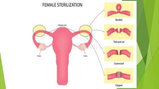 Family Planning (Contraceptive) Methods.pptx