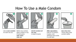 How To Use a Male Condom
 