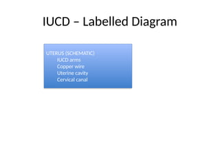 IUCD – Labelled Diagram
UTERUS (SCHEMATIC)
IUCD arms
Copper wire
Uterine cavity
Cervical canal
 