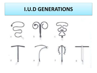 I.U.D GENERATIONS
 