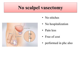 No scalpel vasectomy
• No stitches
• No hospitalization
• Pain less
• Free of cost
• performed in phc also
 
