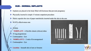 Silactic Rods FAMILY PLANNING METHODS OF CONCEPTION.pptx