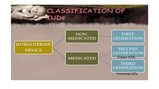 Copper IUDs
Hormonal IUDs
 