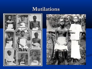 MutilationsMutilations
 