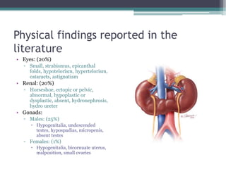 Physical findings reported in the
literature
• Eyes: (20%)
▫ Small, strabismus, epicanthal
folds, hypotelorism, hypertelorism,
cataracts, astignatism
• Renal: (20%)
▫ Horseshoe, ectopic or pelvic,
abnormal, hypoplastic or
dysplastic, absent, hydronephrosis,
hydro ureter
• Gonads:
▫ Males: (25%)
 Hypogenitalia, undescended
testes, hypospadias, micropenis,
absent testes
▫ Females: (1%)
 Hypogenitalia, bicornuate uterus,
malposition, small ovaries
 