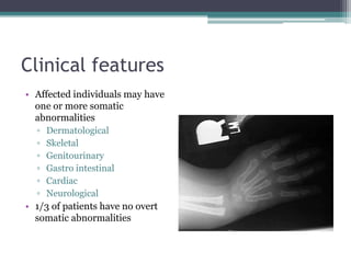 Clinical features
• Affected individuals may have
one or more somatic
abnormalities
▫ Dermatological
▫ Skeletal
▫ Genitourinary
▫ Gastro intestinal
▫ Cardiac
▫ Neurological
• 1/3 of patients have no overt
somatic abnormalities
 
