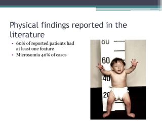 Physical findings reported in the
literature
• 60% of reported patients had
at least one feature
• Microsomia 40% of cases
 