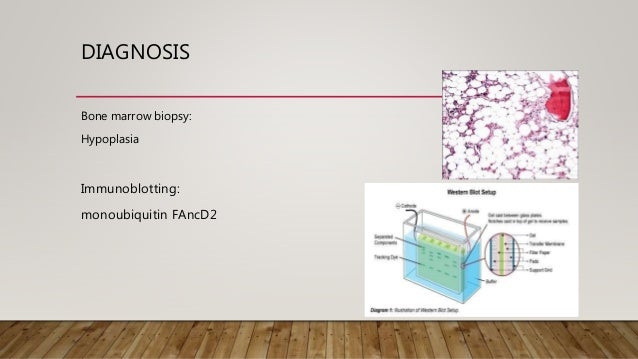 Fanconi anemia