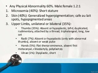 • Any Physical Abnormality 60%. Male:female 1.2:1
1. Microsomia (40%): Short stature
2. Skin (40%): Generalized hyperpigmentation; cafe au lait
spots, hypopigmented areas
3. Upper Limbs, unilateral or bilateral (35%):
• Thumbs (35%): Absent or hypoplastic, bifid, duplicated,
rudimentary, attached by a thread, triphalangeal, long, low
set
• Radii (7%): Absent or hypoplastic (only with abnormal
thumbs), absent or weak pulse
• Hands (5%): Flat thenar eminence, absent first
metacarpal, clinodactyly, polydactyly
• Ulnae (1%): Dysplastic, short
 