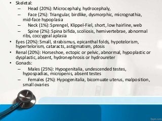 • Skeletal:
– Head (20%): Microcephaly, hydrocephaly,
– Face (2%): Triangular, birdlike, dysmorphic, micrognathia,
mid-face hypoplasia
– Neck (1%): Sprengel, Klippel-Fiel, short, low hairline, web
– Spine (2%): Spina bifida, scoliosis, hemivertebrae, abnormal
ribs, coccygeal aplasia
• Eyes (20%): Small, strabismus, epicanthal folds, hypotelorism,
hypertelorism, cataracts, astigmatism, ptosis
• Renal (20%): Horseshoe, ectopic or pelvic, abnormal, hypoplastic or
dysplastic, absent, hydronephrosis or hydroureter
• Gonads:
– Males (25%): Hypogenitalia, undescended testes,
hypospadias, micropenis, absent testes
– Females (2%): Hypogenitalia, bicornuate uterus, malposition,
small ovaries
 