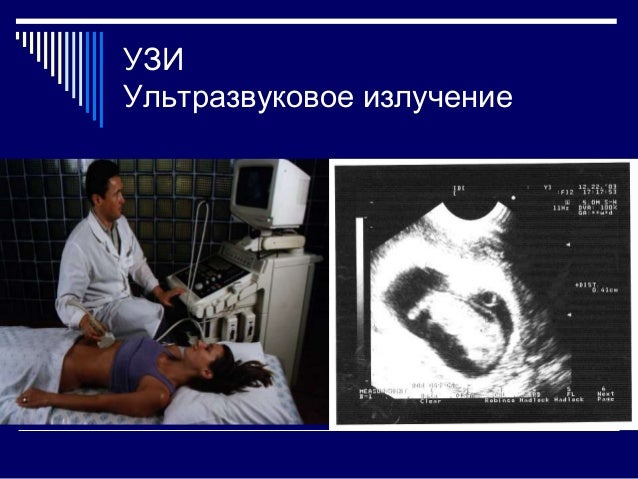 Презентация На Тему Узи