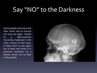 Say “NO” to the Darkness
Some people who have lost
their vision due to trauma
can now see again thanks
to
a
light-sensitive
microchip implanted in the
inner surface of their eyes.
It helps them to see again
but in black and white. It is
powered wirelessly via a
battery which can be kept
in the pocket.

 