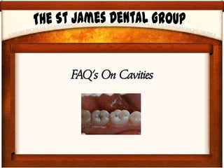 FAQ's On Cavities
 