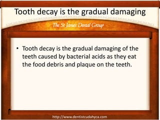 http://www.dentistcudahyca.com
Tooth decay is the gradual damaging
• Tooth decay is the gradual damaging of the
teeth caused by bacterial acids as they eat
the food debris and plaque on the teeth.
The St James Dental Group
 