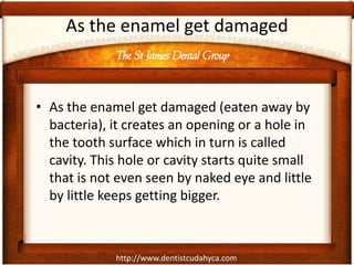 http://www.dentistcudahyca.com
As the enamel get damaged
• As the enamel get damaged (eaten away by
bacteria), it creates an opening or a hole in
the tooth surface which in turn is called
cavity. This hole or cavity starts quite small
that is not even seen by naked eye and little
by little keeps getting bigger.
The St James Dental Group
 