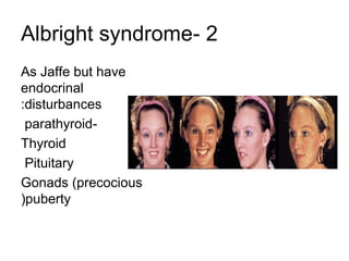 Albright syndrome- 2
As Jaffe but have
endocrinal
:disturbances
parathyroidThyroid
Pituitary
Gonads (precocious
(puberty

 