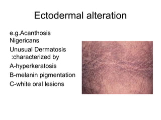Ectodermal alteration
e.g.Acanthosis
Nigericans
Unusual Dermatosis
:characterized by
A-hyperkeratosis
B-melanin pigmentation
C-white oral lesions

 