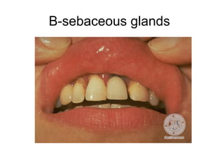B-sebaceous glands

 