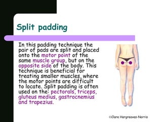 Clare Hargreaves-Norris 
Split padding 
In this padding technique the 
pair of pads are split and placed 
onto the motor point of the 
same muscle group, but on the 
opposite side of the body. This 
technique is beneficial for 
treating smaller muscles, where 
the motor points are difficult 
to locate. Split padding is often 
used on the: pectorals, triceps, 
gluteus medius, gastrocnemius 
and trapezius. 
 