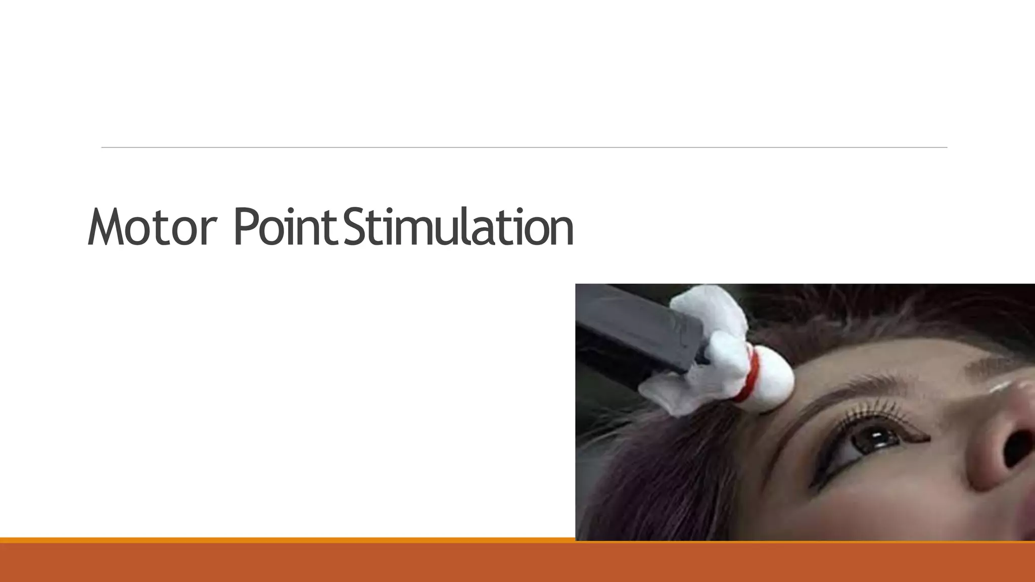 Motor PointStimulation
 