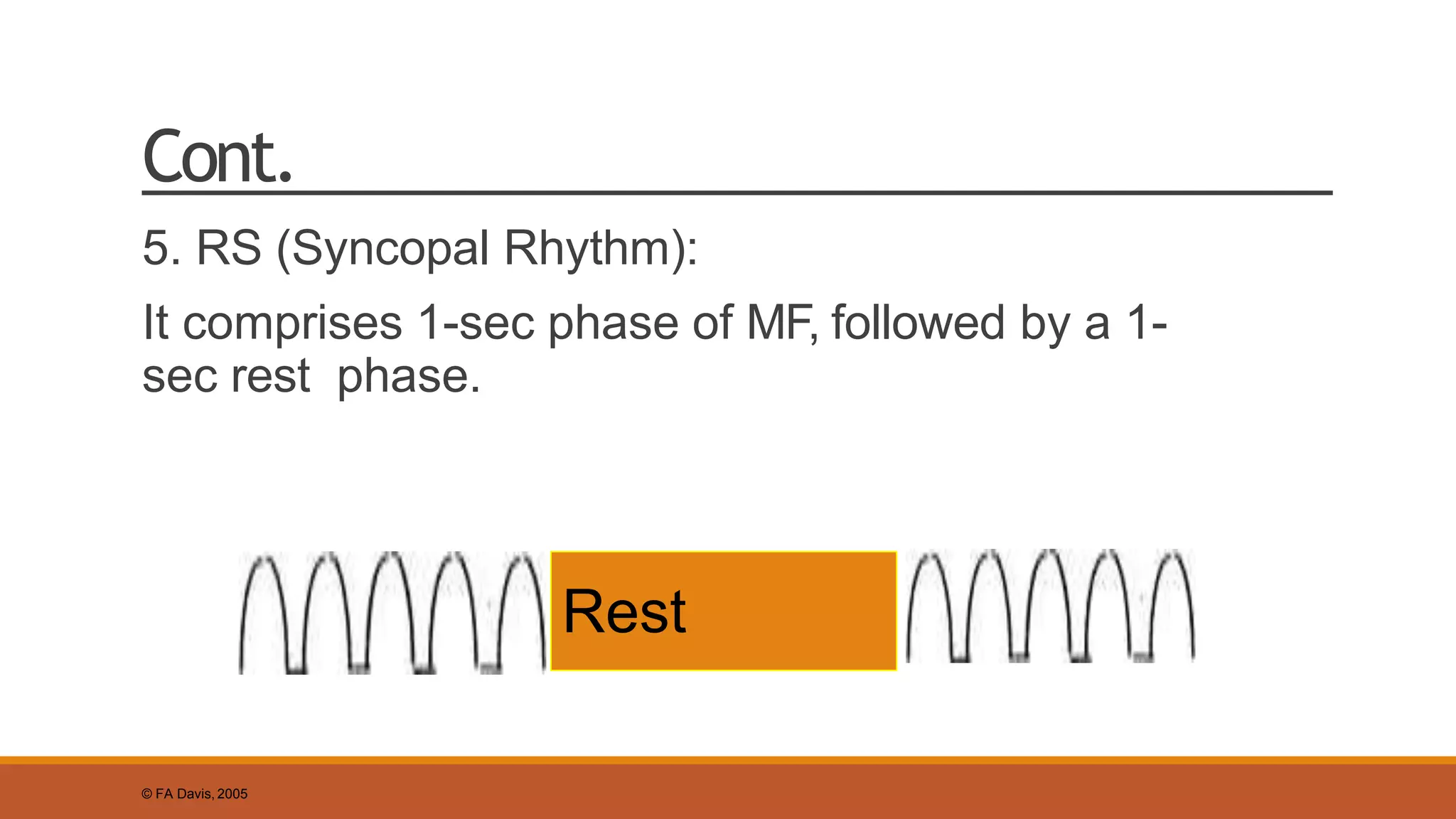 Cont.
5. RS (Syncopal Rhythm):
It comprises 1-sec phase of MF, followed by a 1-
sec rest phase.
© FA Davis, 2005
Rest
 