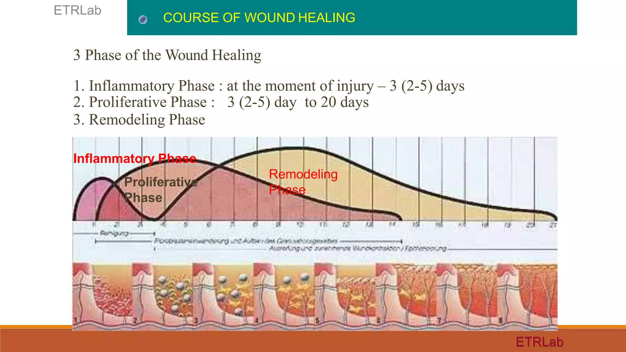 3 Phase of the Wound Healing
1. Inflammatory Phase : at the moment of injury – 3 (2-5) days
2. Proliferative Phase : 3 (2-5) day to 20 days
3. Remodeling Phase
COURSE OF WOUND HEALING
ETRLab
ETRLab
Inflammatory Phase
Proliferative
Phase
Remodeling
Phase
 