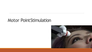 Motor PointStimulation
 