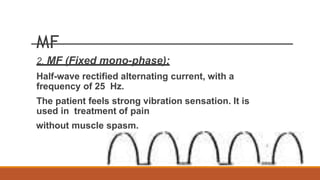 MF
2. MF (Fixed mono-phase):
Half-wave rectified alternating current, with a
frequency of 25 Hz.
The patient feels strong vibration sensation. It is
used in treatment of pain
without muscle spasm.
 