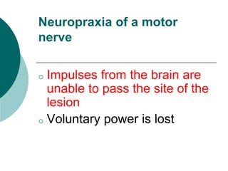 Neuropraxia of a motor
nerve
o Impulses from the brain are
unable to pass the site of the
lesion
o Voluntary power is lost
 
