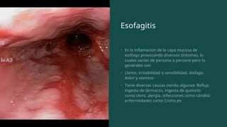 Anatomia de la faringe y esofago de nivel pregrado | PPTX
