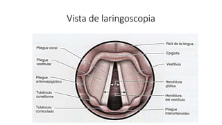 Vista de laringoscopia
 