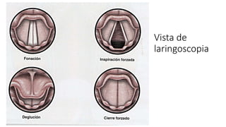Vista de
laringoscopia
 