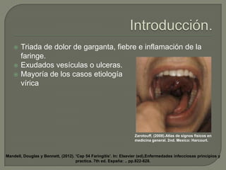 



Triada de dolor de garganta, fiebre e inflamación de la
faringe.
Exudados vesículas o ulceras.
Mayoría de los casos etiología
vírica

Zarotouff, (2008).Atlas de signos físicos en
medicina general. 2nd. Mexico: Harcourt.

Mandell, Douglas y Bennett, (2012). 'Cap 54 Faringitis'. In: Elsevier (ed),Enfermedades infecciosas principios y
practica. 7th ed. España: .. pp.822-828.

 