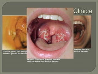 Zarotouff, (2008).Atlas de signos físicos en
medicina general. 2nd. Mexico: Harcourt.

Zarotouff, (2008).Atlas de signos físicos en
medicina general. 2nd. Mexico: Harcourt.

Zarotouff, (2008).Atlas de signos físicos en
medicina general. 2nd. Mexico: Harcourt.

 