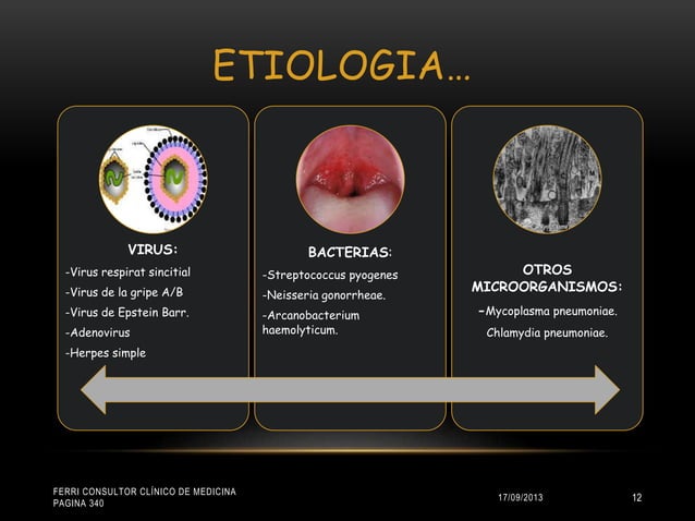 Faringitis | PPT