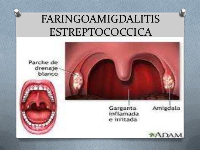 Sinusitis 1 Kant Sinusitis 1 Kant