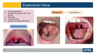 Exploración física
12
Hemograma
● Faringe eritematosa
● Exudado blanquecino que no se
adhiere
● Petequias
● Úvula inflamada
● Ganglios cervicales inflamados
Estructuras linfoides
Leucocitosis «
 