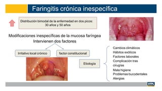 Faringitis crónica inespecífica
Modificaciones inespecíficas de la mucosa faríngea
Intervienen dos factores
Distribución bimodal de la enfermedad en dos picos:
30 años y 50 años
Irritativo local crónico factor constitucional
Etiología
Cambios climáticos
Hábitos exóticos
Factores laborales
Complicación tras
cirugías
Mala higiene
Problemas bucodentales
Alergias
 