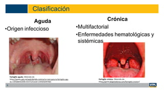 Clasificación
Aguda
•Origen infeccioso
Crónica
•Multifactorial
•Enfermedades hematológicas y
sistémicas
6
Faringitis aguda. Obtenido de:
https://www.uab.cat/web/detalle-noticia/un-test-para-la-faringitis-agu
da-1345680342040.html?articleId=1345656497681
Faringitis crónica. Obtenido de:
https://www.blogmedicina.com/faringitis-cronica/
 