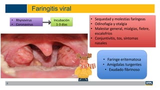 Faringitis viral
8
• Rhynovirus
• Coronavirus
Incubación
1-3 días
• Sequedad y molestias faríngeas
• Odinofagia y otalgia
• Malestar general, mialgias, fiebre,
escalofríos
• Conjuntivitis, tos, síntomas
nasales
• Faringe eritematosa
• Amígdalas turgentes
• Exudado fibrinoso
 