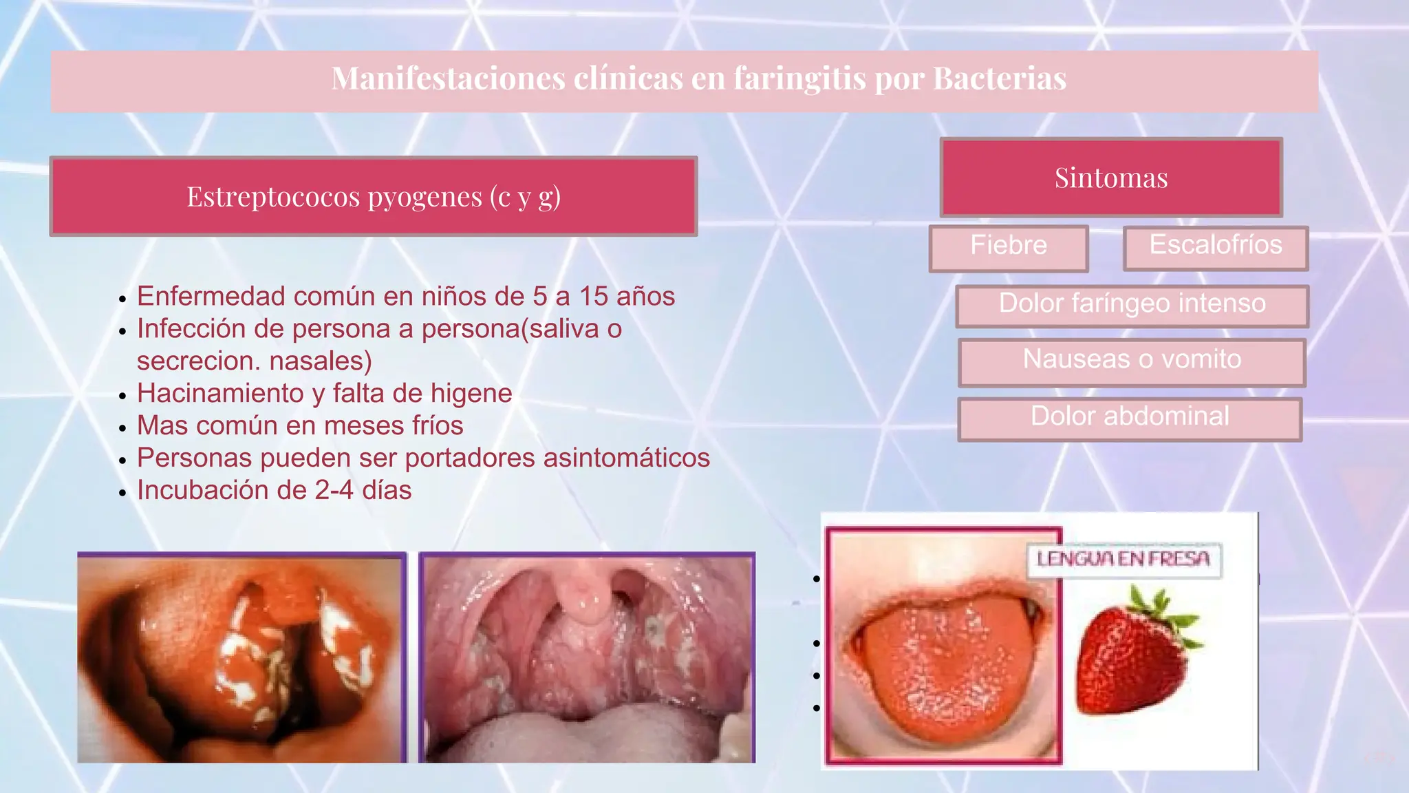 Faringitis Janeth Guadalupe Montalvo Sanchez 4a.pptx.pdf