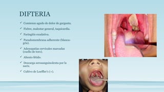 DIFTERIA
 Comienzo agudo de dolor de garganta.
 Fiebre, malestar general, taquicardia.
 Faringitis exudativa.
 Pseudomembrana adherente (blanca-
gris).
 Adenopatías cervicales marcadas
(cuello de toro).
 Aliento fétido.
 Descarga serosanguinolenta por la
nariz.
 Cultivo de Loeffler’s (+).
 