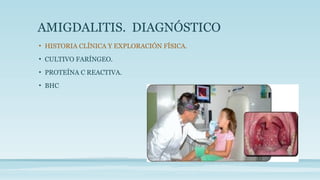 AMIGDALITIS. DIAGNÓSTICO
• HISTORIA CLÍNICA Y EXPLORACIÓN FÍSICA.
• CULTIVO FARÍNGEO.
• PROTEÍNA C REACTIVA.
• BHC
 
