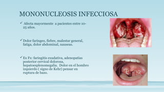 MONONUCLEOSIS INFECCIOSA
 Afecta mayormente a pacientes entre 10-
25 años.
Dolor faríngeo, fiebre, malestar general,
fatiga, dolor abdominal, nauseas.
Ex Fx: faringitis exudativa, adenopatías
posterior cervical dolorosa,
hepatoesplenomegalia. Dolor en el hombro
izquierdo ( signo de Kehr) pensar en
ruptura de bazo.
 