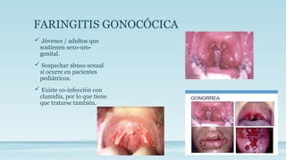 FARINGITIS GONOCÓCICA
 Jóvenes / adultos que
sostienen sexo-oro-
genital.
 Sospechar abuso sexual
si ocurre en pacientes
pediátricos.
 Existe co-infección con
clamidia, por lo que tiene
que tratarse también.
 