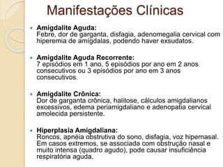  Amigdalite Aguda:
Febre, dor de garganta, disfagia, adenomegalia cervical com
hiperemia de amígdalas, podendo haver exsudatos.
 Amigdalite Aguda Recorrente:
7 episódios em 1 ano, 5 episódios por ano em 2 anos
consecutivos ou 3 episódios por ano em 3 anos
consecutivos.
 Amigdalite Crônica:
Dor de garganta crônica, halitose, cálculos amigdalianos
excessivos, edema periamigdaliano e adenopatia cervical
amolecida persistente.
 Hiperplasia Amigdaliana:
Roncos, apnéia obstrutiva do sono, disfagia, voz hipernasal.
Em casos extremos, se associada com obstrução nasal e
muito intensa (quadro agudo), pode causar insuficiência
respiratória aguda.
Manifestações Clínicas
 