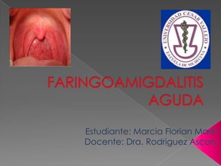 FARINGOAMIGDALITIS AGUDA Estudiante: Marcia FlorianMarin Docente: Dra. RodriguezAscon. 