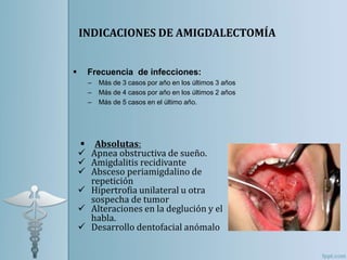 INDICACIONES DE AMIGDALECTOMÍA
 Frecuencia de infecciones:
– Más de 3 casos por año en los últimos 3 años
– Más de 4 casos por año en los últimos 2 años
– Más de 5 casos en el último año.
 Absolutas:
 Apnea obstructiva de sueño.
 Amigdalitis recidivante
 Absceso periamigdalino de
repetición
 Hipertrofia unilateral u otra
sospecha de tumor
 Alteraciones en la deglución y el
habla.
 Desarrollo dentofacial anómalo
 